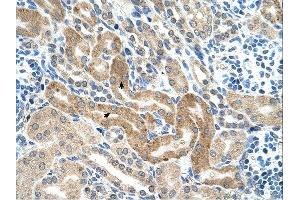 CHAF1B antibody was used for immunohistochemistry at a concentration of 4-8 ug/ml. (CHAF1B Antikörper)