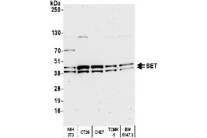 Western Blotting (WB) image for anti-SET Nuclear Oncogene (SET) (AA 125-175) antibody (ABIN7454812)