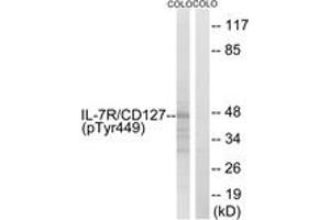 Western blot analysis of extracts from COLO205 cells, using IL-7R/CD127 (Phospho-Tyr449) Antibody. (IL7R Antikörper  (pTyr449))