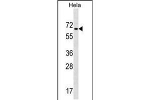 Western blot analysis in Hela cell line lysates (35ug/lane). (ZNF35 Antikörper  (AA 152-181))