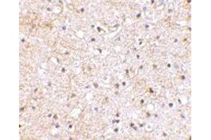 Immunohistochemical staining of human brain tissue using GRIK1 polyclonal antibody  at 2. (GRIK1 Antikörper  (C-Term))