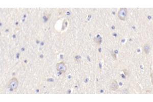 Detection of RETN in Bovine Cerebrum Tissue using Polyclonal Antibody to Resistin (RETN) (Resistin Antikörper  (AA 19-109))
