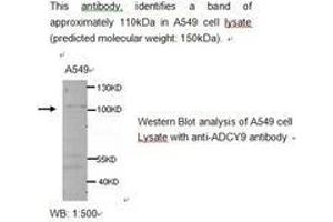 Image no. 1 for anti-Adenylate Cyclase 9 (ADCY9) antibody (ABIN790779) (ADCY9 Antikörper)