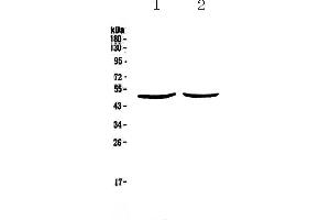 Western blot analysis of PLAU using anti-PLAU antibody . (PLAU Antikörper  (AA 179-431))