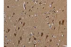 The image on the left is immunohistochemistry of paraffin-embedded Human brain tissue using ABIN7191019(HSPG2 Antibody) at dilution 1/50, on the right is treated with synthetic peptide. (HSPG2 Antikörper)