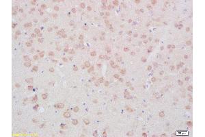 Formalin-fixed and paraffin embedded rat brain tissue labeled with Anti- TPH (Ser19) Polyclonal Antibody, Unconjugated(ABIN2179763) 1:200 followed by conjugation to the secondary antibody and DAB staining (Tryptophan Hydroxylase 2 Antikörper  (pSer19))