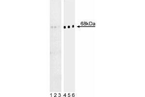 Western blot analysis of BLNK (pY84) in human Burkitt’s lymphoma. (B-Cell Linker Antikörper  (pTyr84))