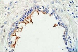 Human lung tissue was staned by Rabbit Anti-AdrenomeduIIiln (1-44) (Human) Antibody (Adrenomedullin Antikörper  (AA 1-44))