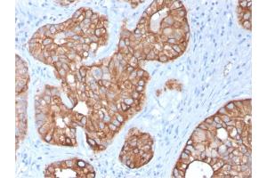 Immunohistochemistry (IHC) image for anti-Keratin 15 (KRT15) antibody (ABIN6939913)