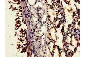 Immunohistochemistry of paraffin-embedded human lung tissue using ABIN7148376 at dilution of 1:100 (CD55 Antikörper  (AA 35-126))