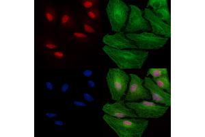 Phospho-MSH2 (Tyr238) Antibody staining A549 cells(heat shock treatment) by IF/ICC. (MSH2 Antikörper  (pTyr238))