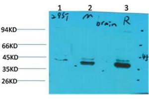 Western Blot (WB) analysis of 1)293T, 2)Mouse Brain Tissue, 3) Rat Brain Tissue with CABP2 Rabbit Polyclonal Antibody diluted at 1:2000. (CABP2 Antikörper)