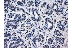 Immunohistochemical staining of paraffin-embedded breast tissue using anti-RPA2 mouse monoclonal antibody. (RPA2 Antikörper)