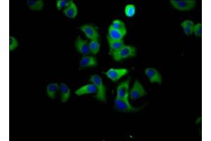 Immunofluorescence staining of MCF-7 cells with ABIN7143399 at 1:133, counter-stained with DAPI. (Adhesion G Protein-Coupled Receptor G1 (ADGRG1) (AA 26-216) Antikörper)