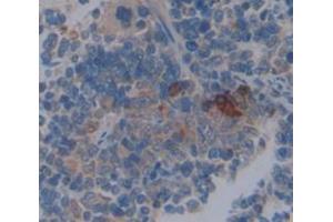 Used in DAB staining on fromalin fixed paraffin- embedded spleen tissue (Coronin 1a Antikörper  (AA 1-204))