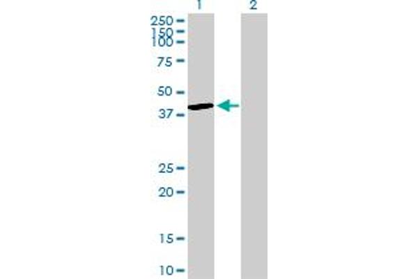 DUSP4 Antikörper  (AA 1-394)