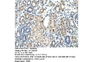 Rabbit Anti-PBEF1 Antibody  Paraffin Embedded Tissue: Human Kidney Cellular Data: Epithelial cells of renal tubule Antibody Concentration: 4. (NAMPT Antikörper  (C-Term))