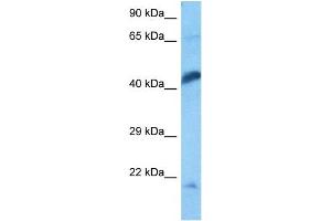 Host:  Rat  Target Name:  ENO1  Sample Tissue:  Rat Skeletal Muscle  Antibody Dilution:  1ug/ml (ENO1 Antikörper  (C-Term))