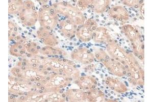 IHC-P analysis of Rat Kidney Tissue, with DAB staining. (GAMT Antikörper  (AA 2-236))
