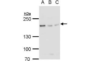 WB Image BLM antibody detects BLM protein by western blot analysis.