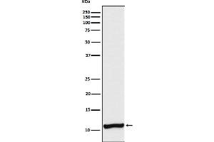 Western blot analysis of Cellubrevin expression in A375 cell lysate.