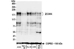 Western Blotting (WB) image for anti-Zinc Finger CCCH-Type Containing 4 (ZC3H4) (AA 1050-1100) antibody (ABIN7795761)