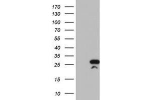 Western Blotting (WB) image for anti-Regulator of G-Protein Signaling 16 (RGS16) antibody (ABIN1500694) (RGS16 Antikörper)