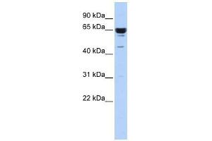 Western Blot showing ZNF587 antibody used at a concentration of 1-2 ug/ml to detect its target protein. (ZNF587 Antikörper  (Middle Region))
