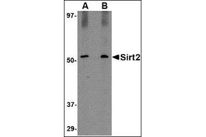 Western blot analysis of SIRT2 in Mouse brain lysate with AP30785PU-N SIRT2 antibody at (A) 1 and (B) 2 μg/ml. (SIRT2 Antikörper  (C-Term))