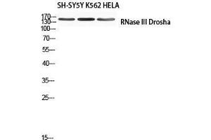 Western Blot (WB) analysis of SH-SY5Y K562 HeLa using RNase III Drosha antibody. (DROSHA Antikörper)