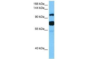 Host:  Mouse  Target Name:  HDAC4  Sample Tissue:  Mouse Testis  Antibody Dilution:  1ug/ml (HDAC4 Antikörper  (Middle Region))