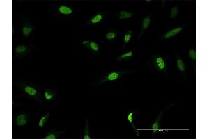 Immunofluorescence of purified MaxPab antibody to ZNF582 on HeLa cell.