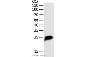 Western blot analysis of Human liver cancer tissue, using CRP Polyclonal Antibody at dilution of 1:1400 (CRP Antikörper)