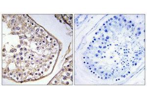 Immunohistochemistry (IHC) image for anti-B Melanoma Antigen Family, Member 3 (BAGE3) (Internal Region) antibody (ABIN1850876)