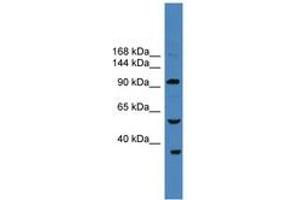 Image no. 1 for anti-Ubiquitin Specific Peptidase 29 (USP29) (AA 181-230) antibody (ABIN6745286) (USP29 Antikörper  (AA 181-230))