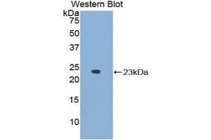 Western blot analysis of the recombinant protein. (NCF2 Antikörper  (AA 354-525))