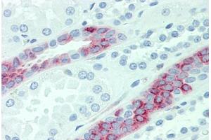 Anti-SLC4A2 antibody  ABIN1049341 IHC staining of human kidney. (SLC4A2 Antikörper  (Internal Region))