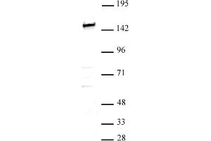 SMARCC1 / BAF155 antibody (pAb) tested by Western blot. (SMARCC1 Antikörper  (N-Term))