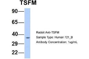 Host: Rabbit Target Name: TSFM Sample Type: Human 721_B Antibody Dilution: 1. (TSFM Antikörper  (Middle Region))
