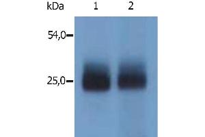 Western Blotting immunostaining with polyclonal anti-mouse NTAL antibody (specific for N-terminal domain of mouse NTAL)