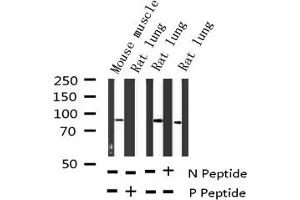 Western blot analysis of Phospho-CD44 (Ser706) expression in various lysates (CD44 Antikörper  (pSer706))