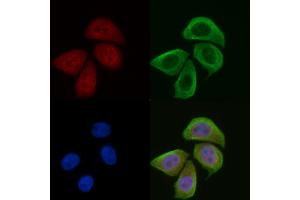 ABIN6256539 and ABIN6274072 staining Hela cells(45 min of heat-shock) by IF/ICC.