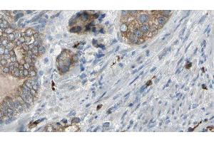 ABIN6276960 at 1/100 staining Human prostate tissue by IHC-P. (TNNC1 Antikörper  (Internal Region))