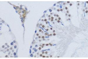 Immunohistochemistry of paraffin-embedded Rat testis using DiMethyl-Histone H3-K79 Polyclonal Antibody at dilution of 1:200 (40x lens).