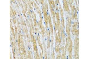 Immunohistochemistry of paraffin-embedded Mouse heart using BAG3 Polyclonal Antibody at dilution of 1:100 (40x lens). (BAG3 Antikörper)