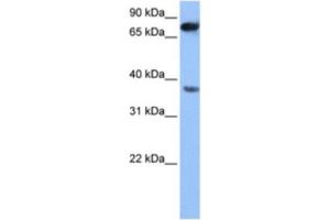 Western Blotting (WB) image for anti-Zinc Finger, CCHC Domain Containing 12 (ZCCHC12) antibody (ABIN2463550) (ZCCHC12 Antikörper)