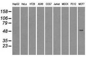 Image no. 1 for anti-Solute Carrier Family 2 (Facilitated Glucose/fructose Transporter), Member 5 (SLC2A5) antibody (ABIN1498478) (SLC2A5 Antikörper)