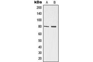 Western blot analysis of p73 expression in Jurkat (A), HeLa (B) whole cell lysates. (Tumor Protein p73 Antikörper  (N-Term))