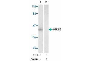 Western blot analysis of extracts from 293 cells untreated or treated with TNF-alpha (20 ng/mL, 15 min) using NFKBIE polyclonal antibody . (NFKBIE Antikörper)