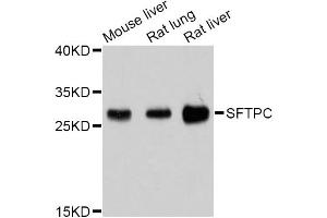 Western blot analysis of extracts of various cell lines, using SFTPC Antibody (ABIN4905145) at 1:1000 dilution. (Surfactant Protein C Antikörper)